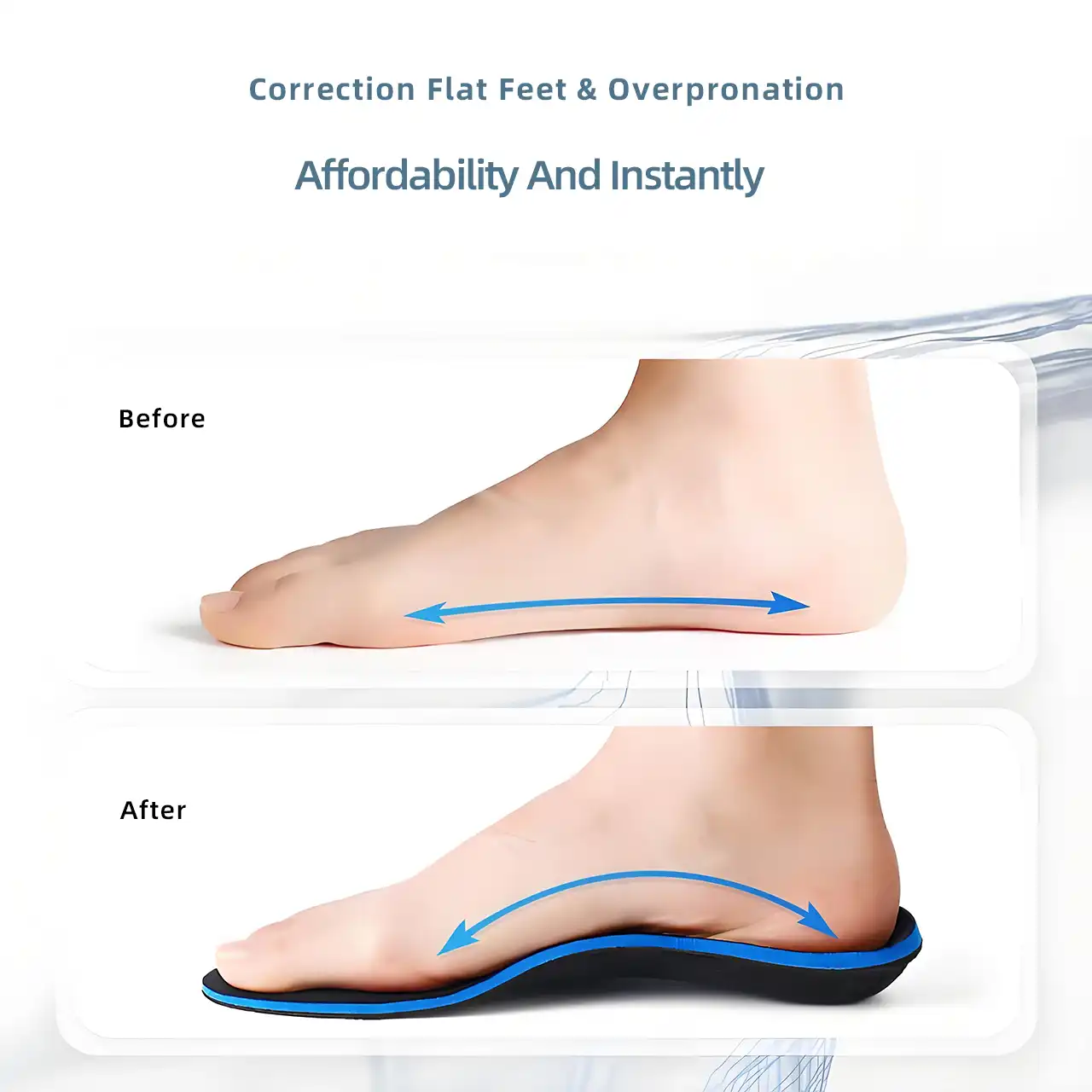 before and after by wearing flat feet insole