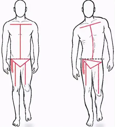 Causes of Leg Length Discrepancy